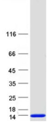 SDS-PAGE (S100A12-063H).jpg